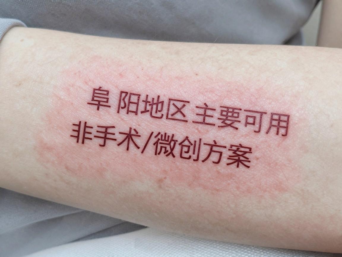 阜阳地区主要可用的非手术/微创方案