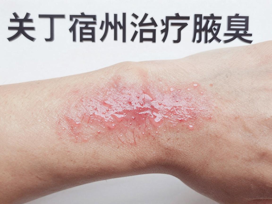 关于宿州治疗腋臭的医院，目前没有名为宿州腋臭医院的独立专科机构，但宿州市有多家公立医院设有普外科或皮肤科，可以提供腋臭（狐臭）的诊疗服务