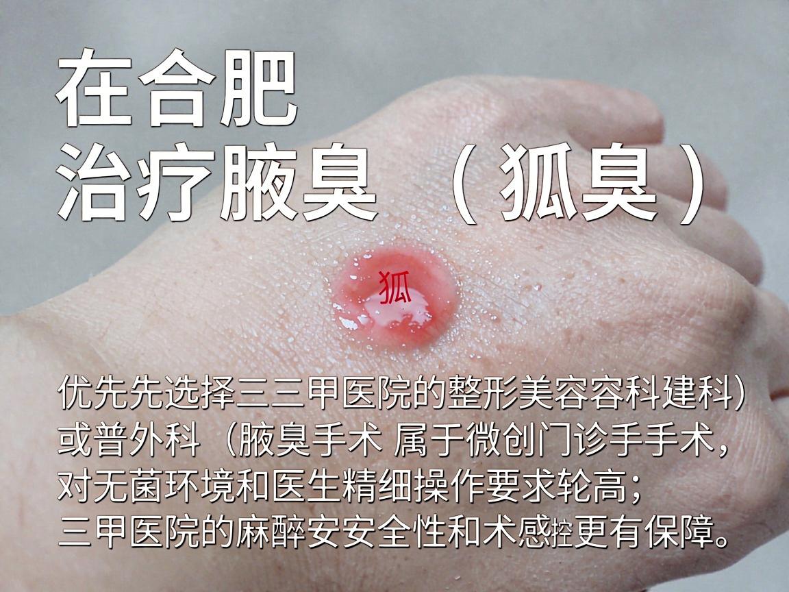 在合肥，治疗腋臭（狐臭）建议优先选择三甲医院的整形美容科或普外科（腋臭专科）因为腋臭手术属于微创门诊手术，对无菌环境和医生精细操作要求较高，三甲医院的麻醉安全性和术后感染控制方面更有保障