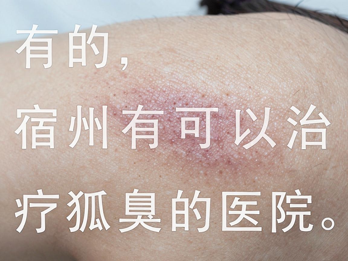 有的,宿州有可以治疗狐臭的医院。通常,宿州市立医院、皖北煤电集团总医院等综合性医院的普外科或皮肤科都可以进行狐臭(腋臭)的诊断和治疗 有的,宿州有可以治疗狐臭的医院。通常,宿州市立医院、皖北煤电集团总医院等综合性医院的普外科或皮肤科都可以进行狐臭(腋臭)的诊断和治疗