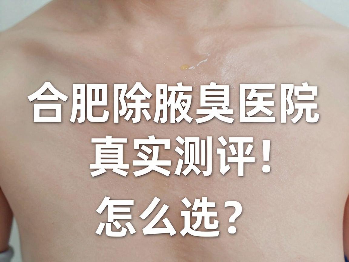 合肥除腋臭医院怎么选？合肥除腋臭医院真实测评，这份指南帮你避开坑