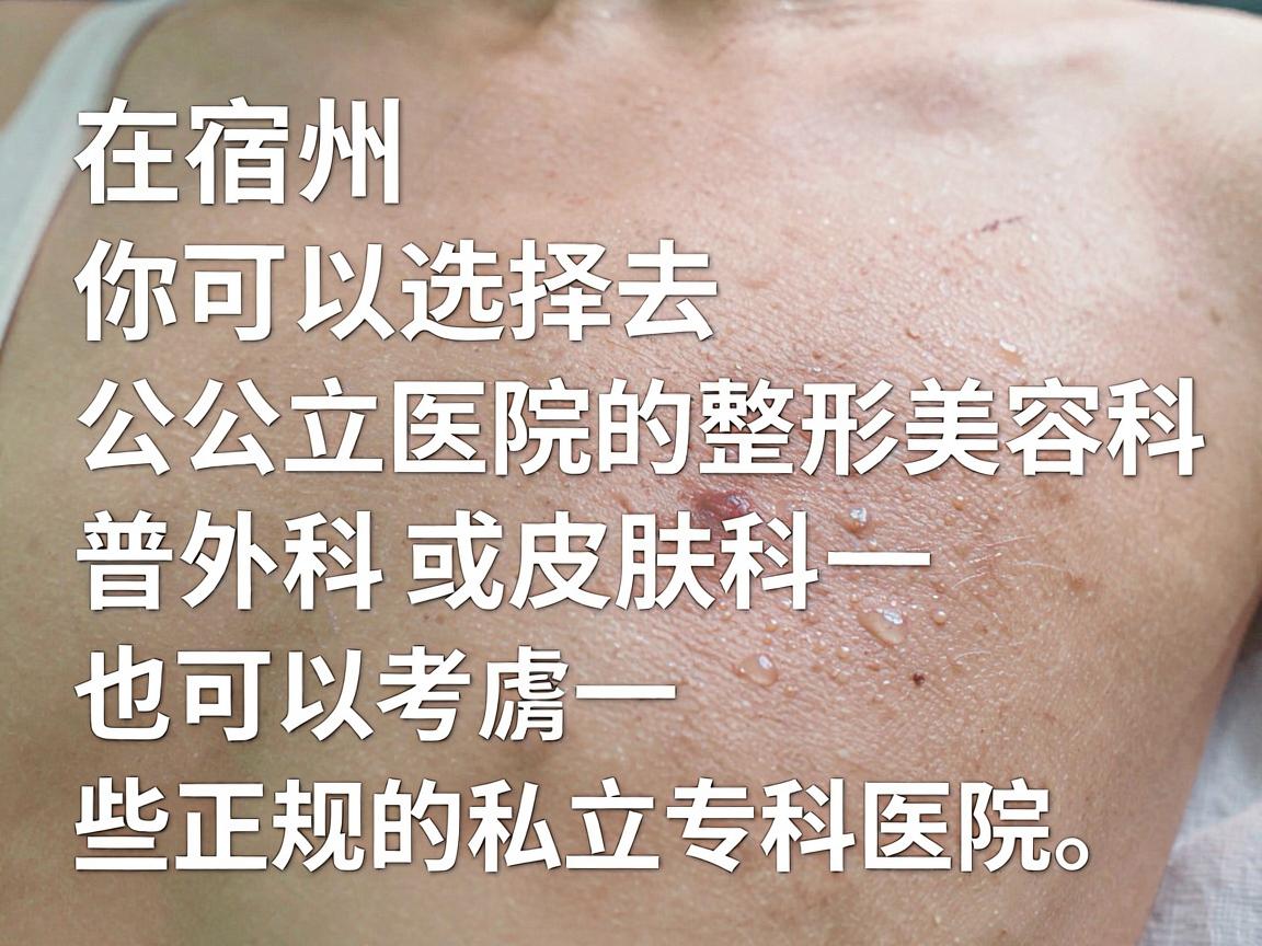 在宿州，你可以选择去公立医院的整形美容科、普外科或皮肤科，也可以考虑一些正规的私立专科医院。以下是具体的推荐和注意事项