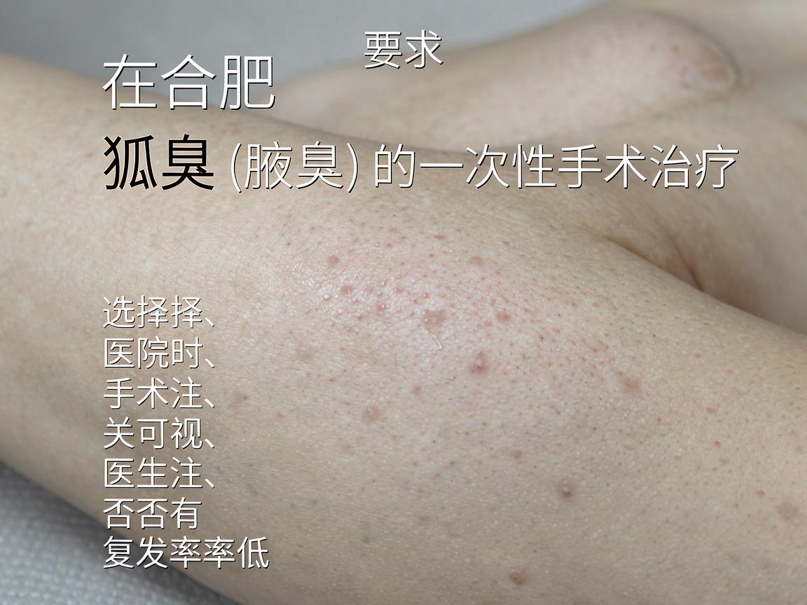 在合肥，针对狐臭（腋臭）的一次性手术治疗，选择医院时需要关注几个关键点，手术技术（如微创、可视）医生经验、以及是否有复发率低的承诺