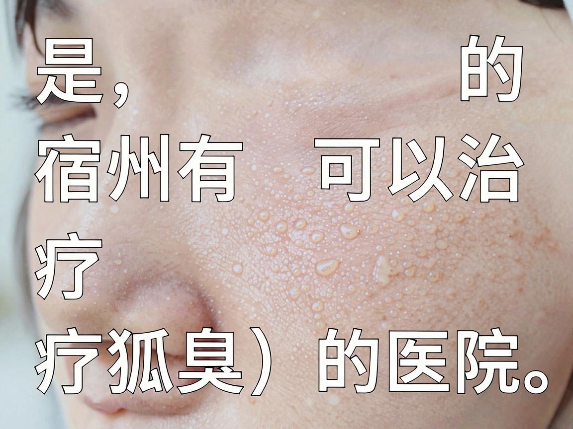 是的，宿州有可以治疗狐臭（腋臭）的医院。一般来说，宿州市的公立综合医院（如宿州市立医院、皖北煤电集团总医院等）的普外科、皮肤科或整形美容科通常都提供狐臭的治疗服务