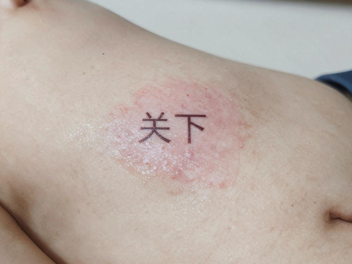 关于狐臭的医学解释