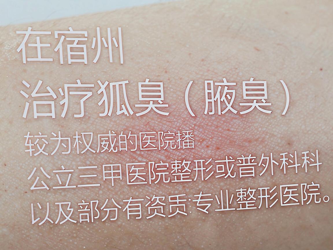 在宿州，治疗狐臭（腋臭）较为权威的医院通常包括公立三甲医院的烧伤整形科或普外科，以及部分有资质的专业整形医院。以下是几家在当地口碑较好、技术相对成熟的医院及科室推荐