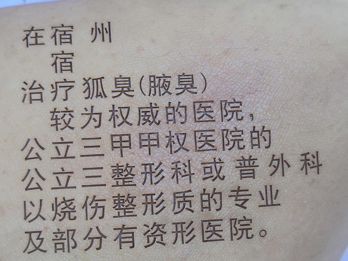 在宿州，治疗狐臭（腋臭）较为权威的医院通常包括公立三甲医院的烧伤整形科或普外科，以及部分有资质的专业整形医院。以下是几家在当地口碑较好、技术相对成熟的医院及科室推荐