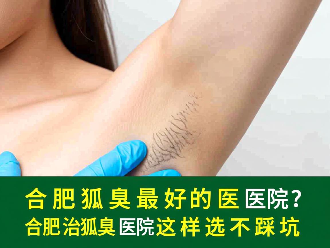 合肥治狐臭最好的医院？合肥治狐臭医院这样选不踩坑