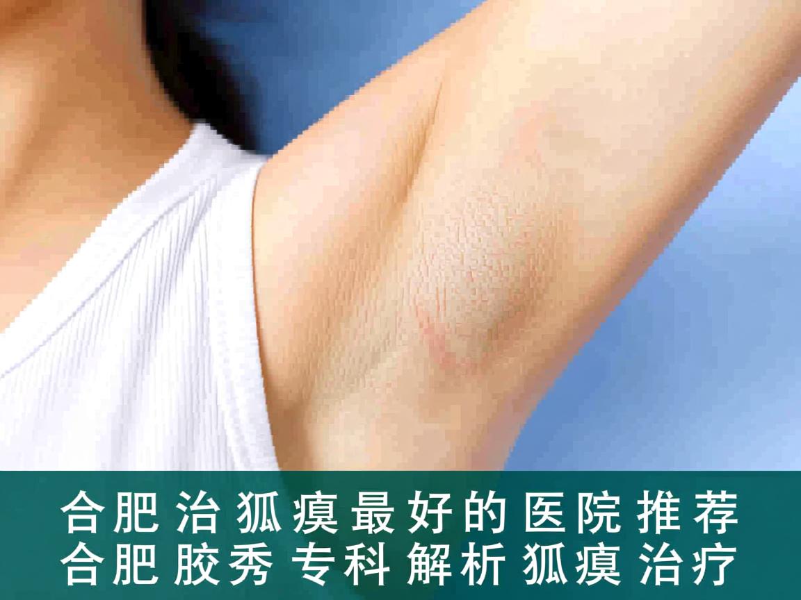 在合肥治疗狐臭最好的医院推荐，合肥腋秀专科解析狐臭治疗