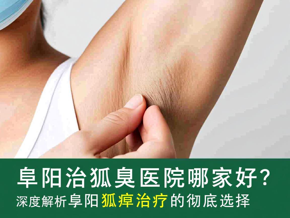 阜阳治狐臭医院哪家好？深度解析阜阳狐臭治疗的彻底选择