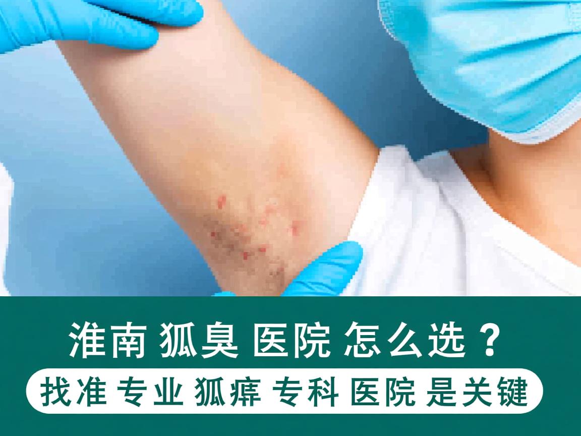 淮南狐臭医院怎么选？找准专业狐臭专科医院是关键