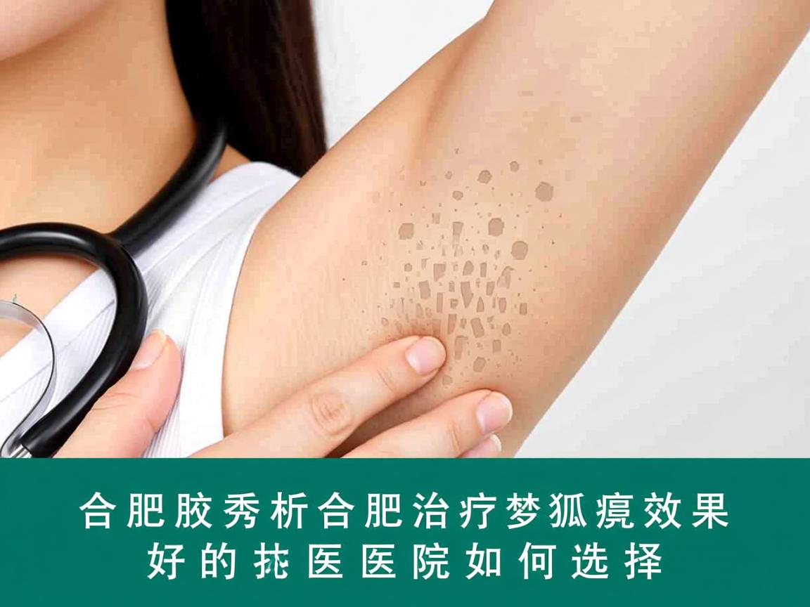 合肥腋秀解析，合肥治疗狐臭效果好的医院如何选择