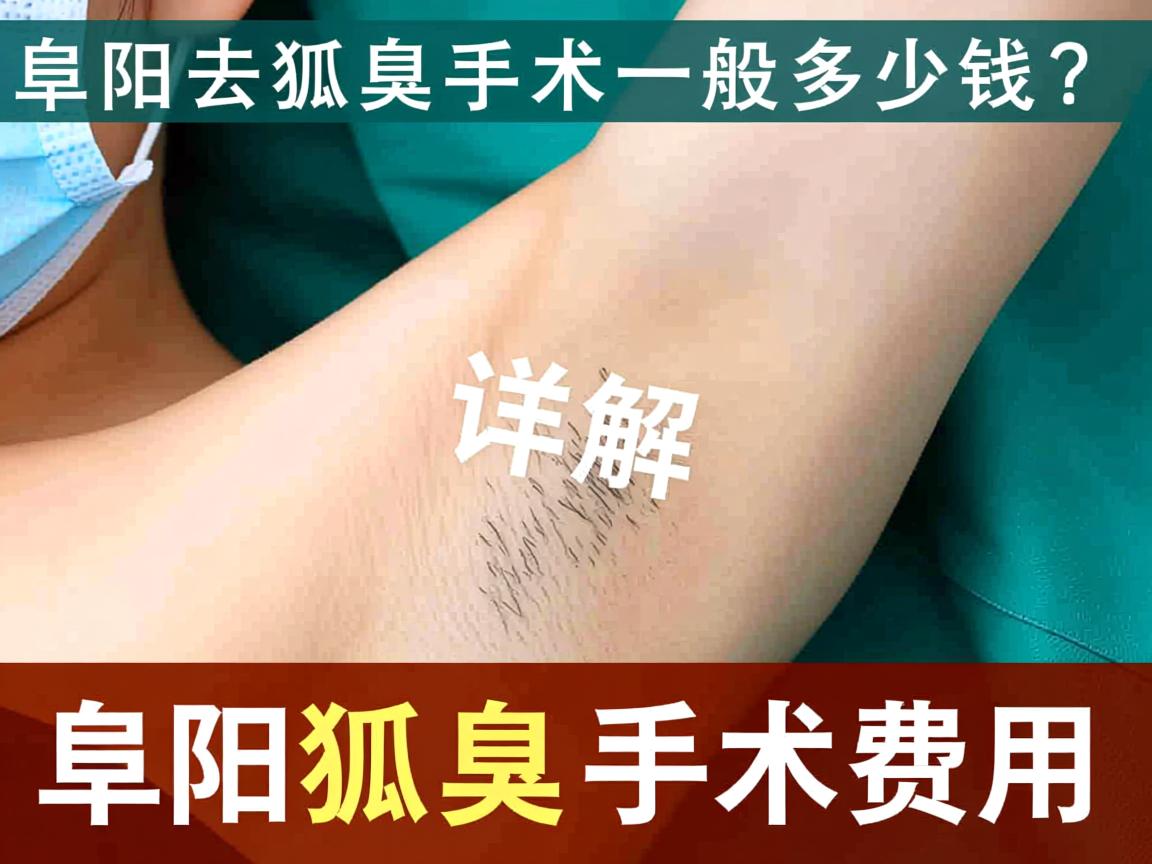 阜阳去狐臭手术一般多少钱？详解阜阳狐臭手术费用