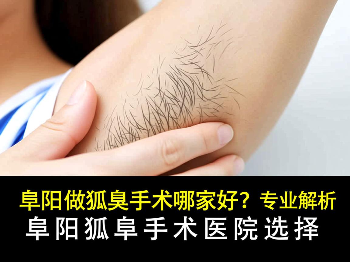 阜阳做狐臭手术哪家好？专业解析阜阳狐臭手术医院选择