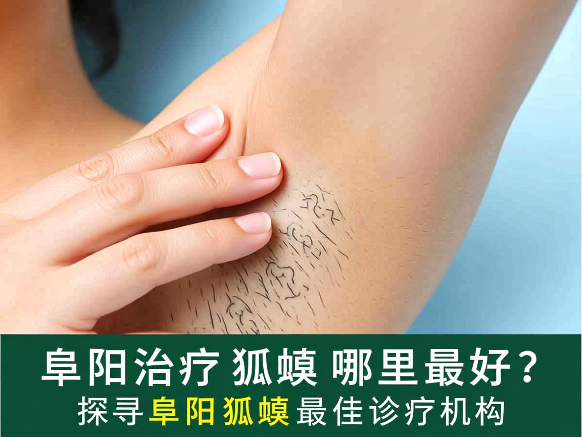 阜阳治疗狐臭哪里最好？探寻阜阳狐臭最佳诊疗机构