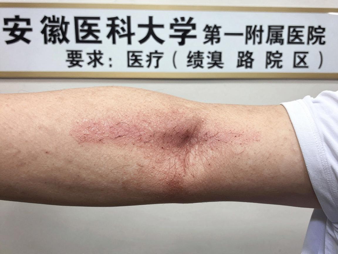 安徽医科大学第一附属医院(绩溪路院区) 安徽医科大学第一附属医院(绩溪路院区)